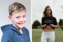 Disfigurement champions speak out on 'devastating' impact of bullying on young people