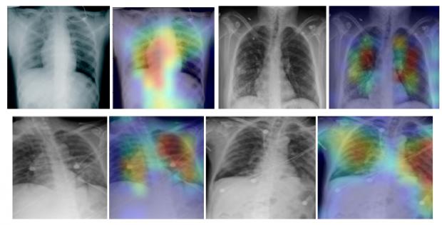 Glasgow Times: Pictured: The technology compares X-Ray imagery from thousands of different patients