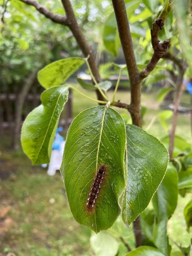 Glasgow Times: Caterpillar rash caused by brown tail moth caterpillar. (SWNS)
