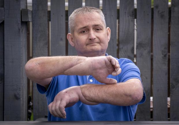 Glasgow Times: Pictured: Steven Gallagher, from Dreghorn, Ayrshire