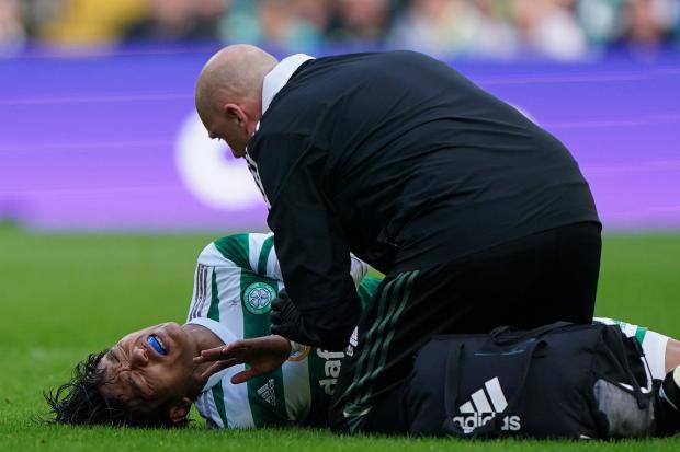 Celtic midfielder Reo Hatate suffered a couple of heavy knocks in the win over Aberdeen.