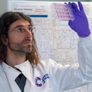 Glasgow scientists take first steps towards urine test for cancer
