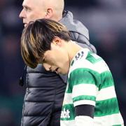 How Celtic should line-up against Rangers if Kyogo injury fears come to light