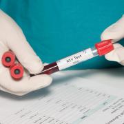 Generic Photo of a Blood collection tube with HIV test label held by technician.
