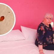 'I slept in a chair for five weeks': Woman demands action after bedbug nightmare