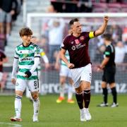 This match against Celtic comes after a 2-1 defeat for Hearts of Midlothian against Aberdeen FC.